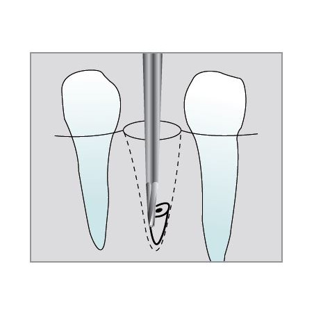 Freze Chirurgicale FGXXL C560