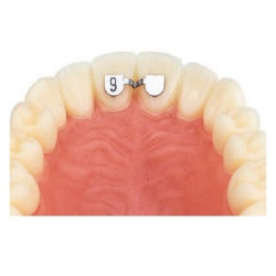 Retainers Sup 6mm 10 Bucati Leone