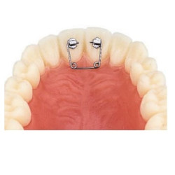 Diastema Kit 20 канюли + 10 пружини Leone