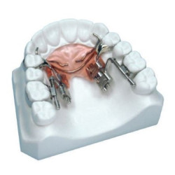 Dispozitiv distalizare dreapta Fast Back 9mm Leone