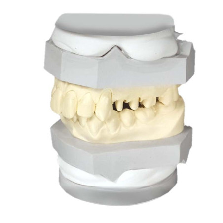 GIPS ARTICULATOR SHERAARTI-QUICK, white 20kg