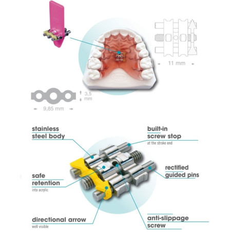 Surub mandibular cu arc Leone